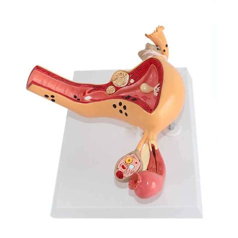 Buy Uterus Anatomical Model Female Reproductive Organ Anatomical Mode