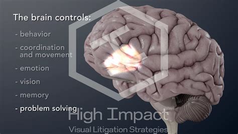 Tbi 101 1 Normal Brain Function On Vimeo