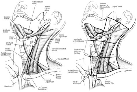 An Imaging Based Classification For The Cervical Nodes Designed As An