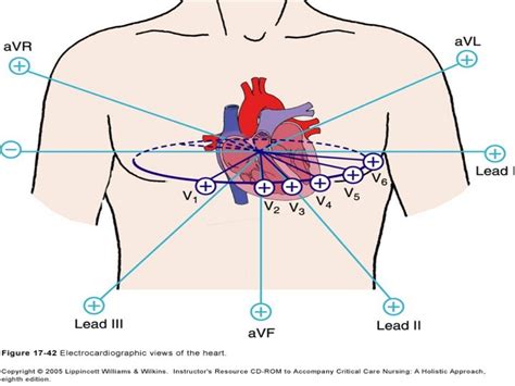 Coronary Arteries And 12 Leads Cardiology Nursing Cardiac Nursing Ob