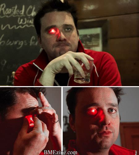 Rob Spence Makes A Stand W His “terminator Eye” And Trys To Get A Camera Eye Loyal K N G