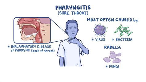 Pharyngitis Nursing Osmosis Video Library