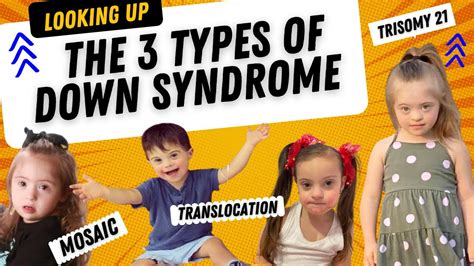 The 3 Types Of Down Syndrome Youtube