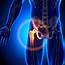Femoroacetabular Impingement FAI Hip Osteoarthritis