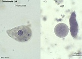 Intestinal Amebae- Subphylum: Sarcodina, Phylum: Sarcomastigophora ...
