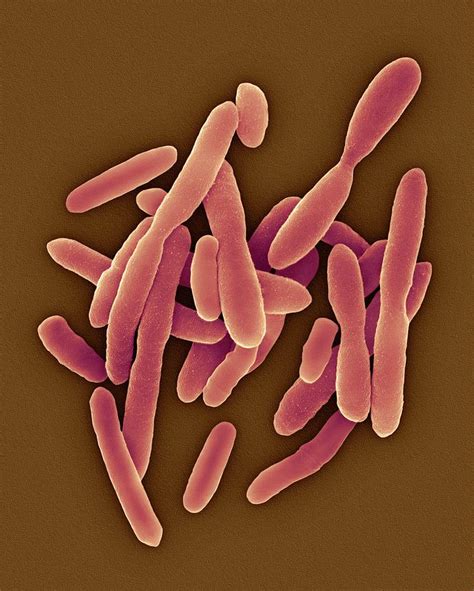 Pseudomonas Sp Gram Negative 1 Photograph By Dennis Kunkel Microscopy