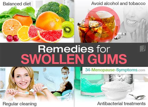 Swollen Gums Remedy Home Remedies For Gum Swellingtop 10 Natural