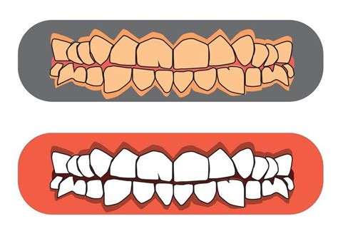 Free Teeth And Gums Vectors 84390 Vector Art At Vecteezy