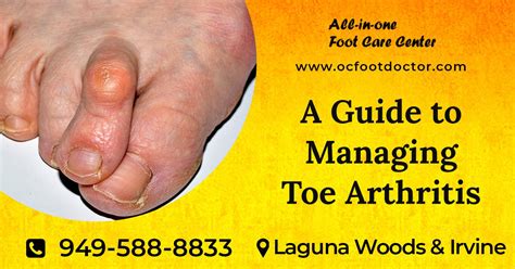 A Guide To Managing Toe Arthritis