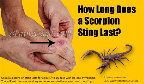 How Long Does A Scorpion Sting Last And What To Do If You Get Stung By A