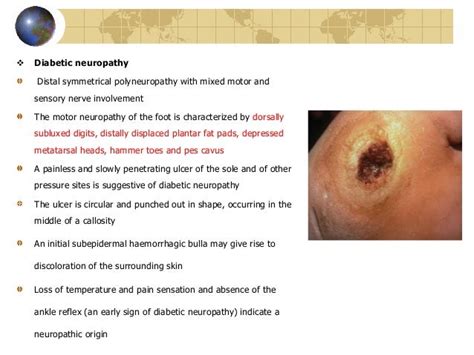 Cutaneous Manifeatations In Endocrine Disorders