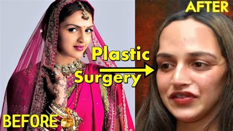 Plastic Surgery Disasters Of Bollywood Actresses Youtube