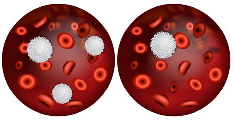 Disorders Of Leukocyteswhite Blood Cells An Overview Interactive