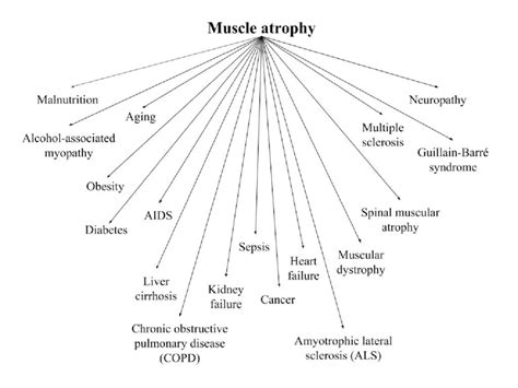 Clinical Conditions Associated With Muscle Atrophy Download