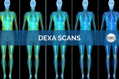 Dual Energy X Ray Absorptiometry Dexa Scans Science For Sport