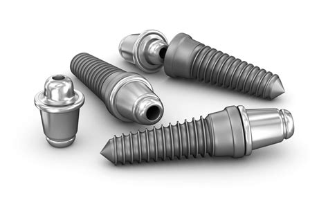 Metal Dental Implants The Smart Choice