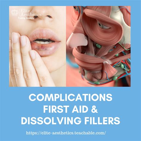 Complications First Aid And Dissolving Dermal Fillers Elite