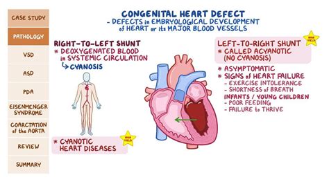 Acyanotic Congenital Heart Defects Pathology Review Osmosis