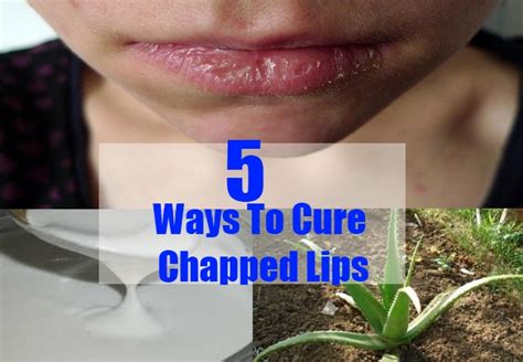Tips On How To Cure Chapped Lips Herbal Supplements