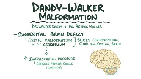 Dandy Walker Malformation Osmosis