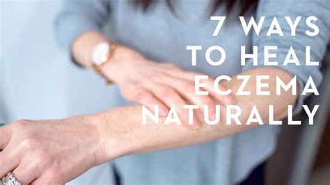 7 Things You Must Know To Get Rid Of Eczema Naturally Youtube
