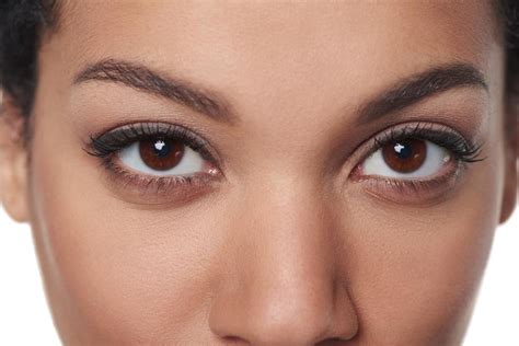 7 Ways To Care For Thin Skin Under Your Eyes