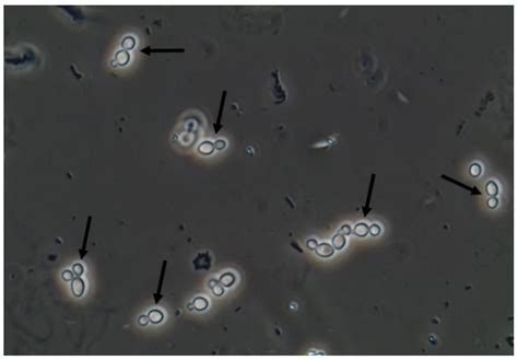 Yeast Cell Under Microscope