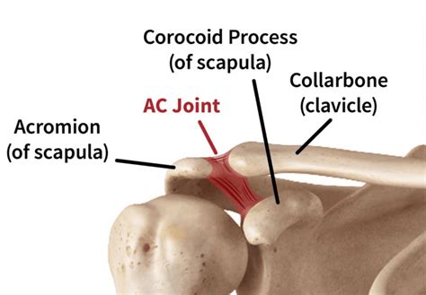 Shoulder Acromioclavicular Joint Injuries Common In Athletes