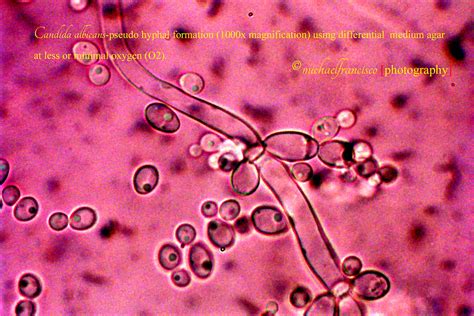 Candida Albicans 1000x Magnification A Photo On Flickriver