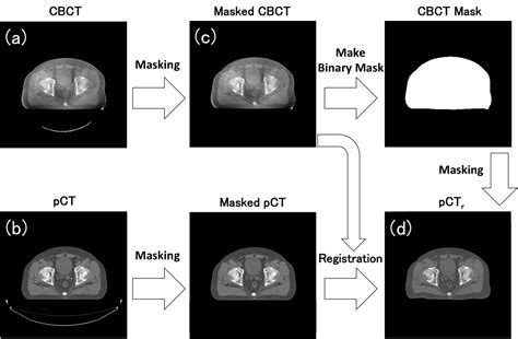 Cureus Cone Beam Computed Tomography Image Quality Improvement Using A Deep Convolutional
