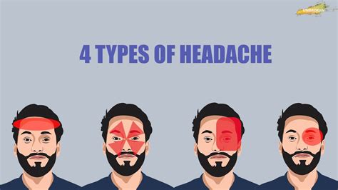 Four Types Of Headache You Should Know Youtube