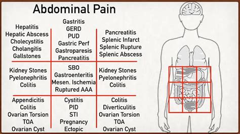 Abdominal Pain Locations Medizzy