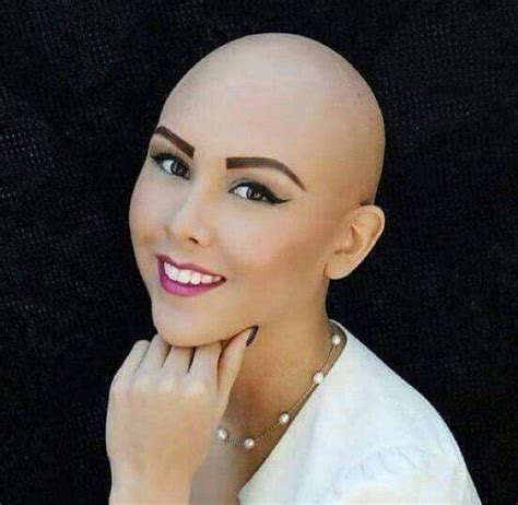 Pin On Bald Women