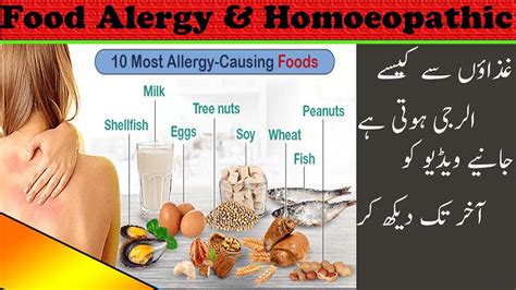 Food Allergy Causes Food Allergy Awarenesss Pediatric Food Allergies
