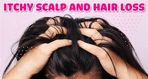 Myth Busting Itchy Scalp And Hair Loss How Are They Related
