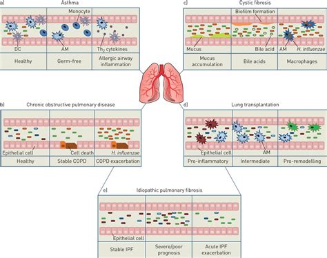 Mechanistic Insight Into The Function Of The Microbiome In Lung