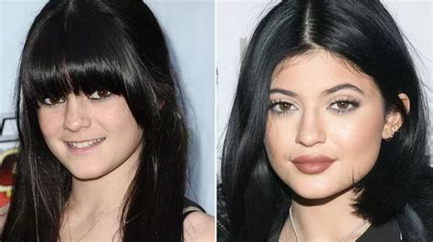 Kylie Jenner Denies Having Lip Implants But Admits She Thinks A Big