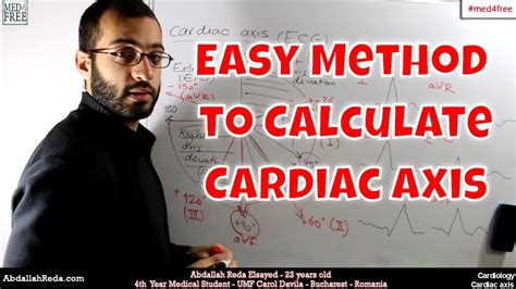 An Easy Method To Calculate The Cardiac Axis عبد الله رضا Md Youtube