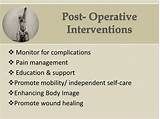 Images of Amputation Pain Management