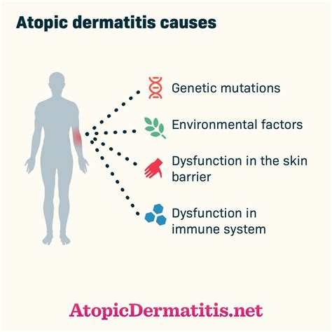 Atopic Dermatitis Causes Atopic Dermatitis Eczema Causes Dermatitis