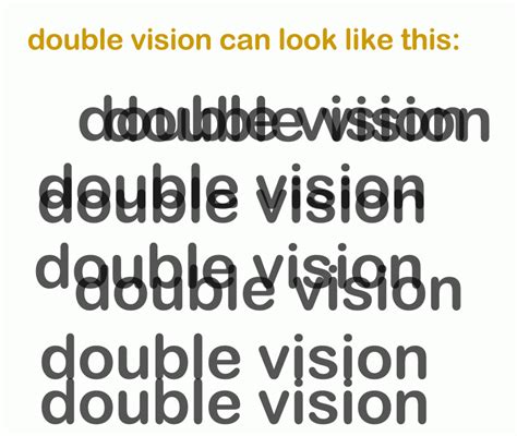 Double Vision Diplopia Causes Symptoms And Treatment
