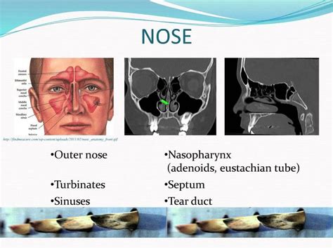 Pediatric Ear Nose And Throat Infections With Dr Soham Roy