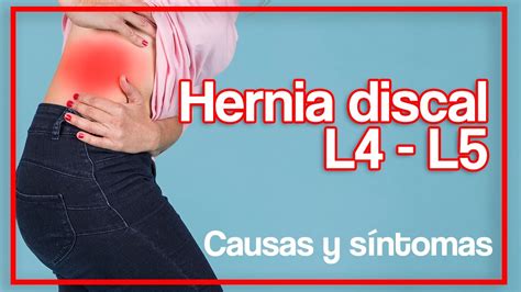 Causas Y Síntomas De Hernia Discal L4 L5 Youtube