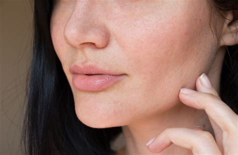 What Causes Clogged Pores