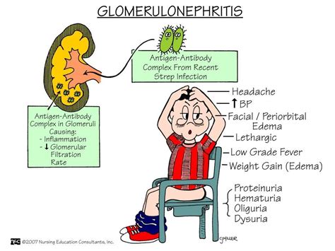 Nephrotic Syndrome And Its Particular Pathogenesis In