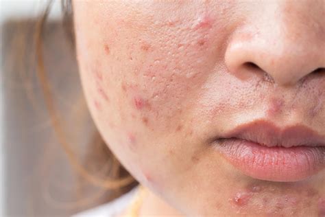Signs Your Skin Products Are Bad For Your Skin The Healthy
