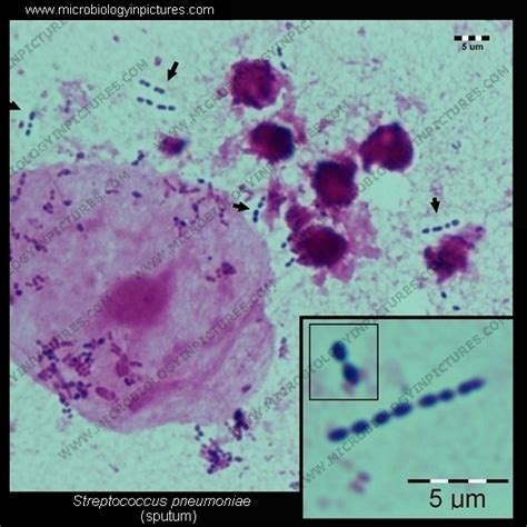 Bacteria Streptococcus Pneumococcus Pneumoniae A Gram Positive Hot