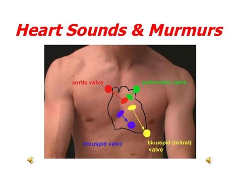 Heart Sounds And Murmurs By Sherry Knowles Via Slideshare Medicine