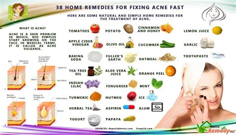 38 Home Remedies For Fixing Acne Fast Home Remedies