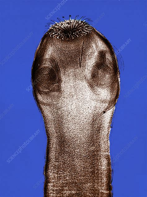 Dog Tapeworm Scolex Lm Stock Image C0176018 Science Photo Library